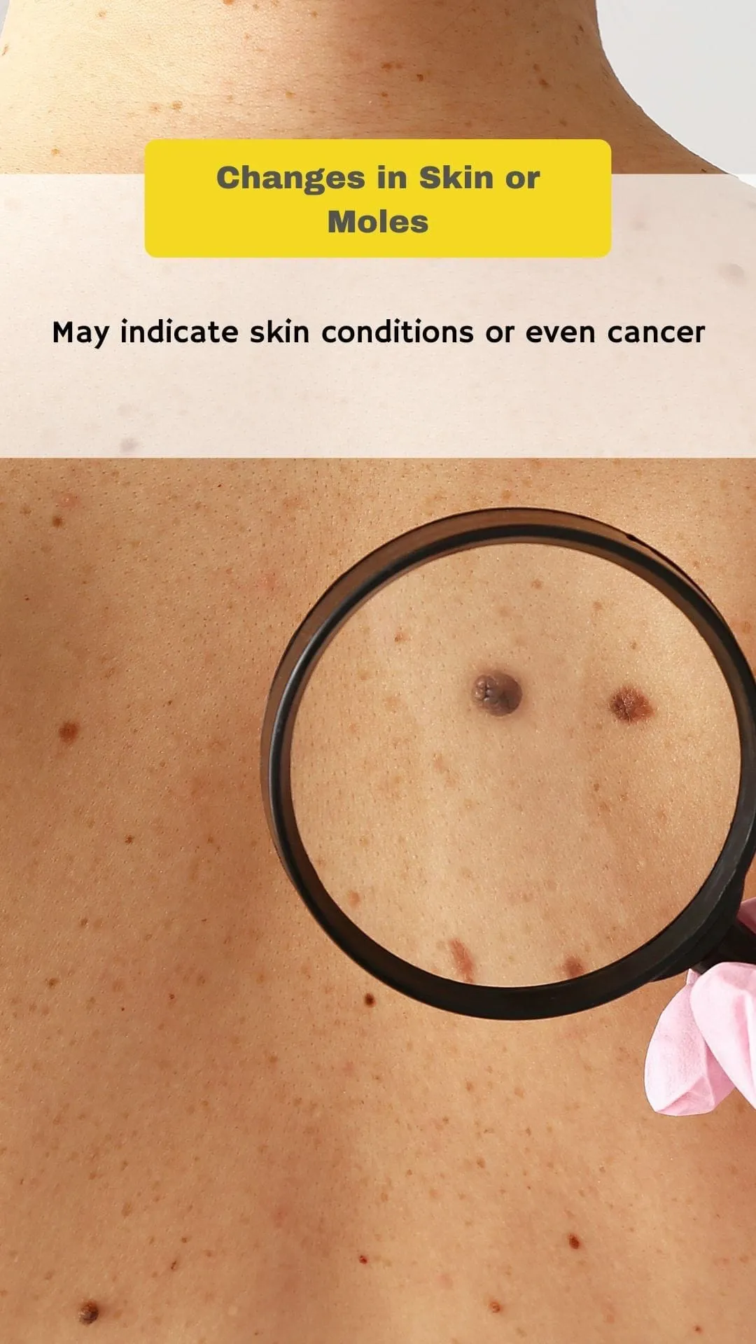 7 signs you need a health checkup, slide 7