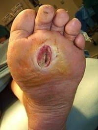 Know Diabetes